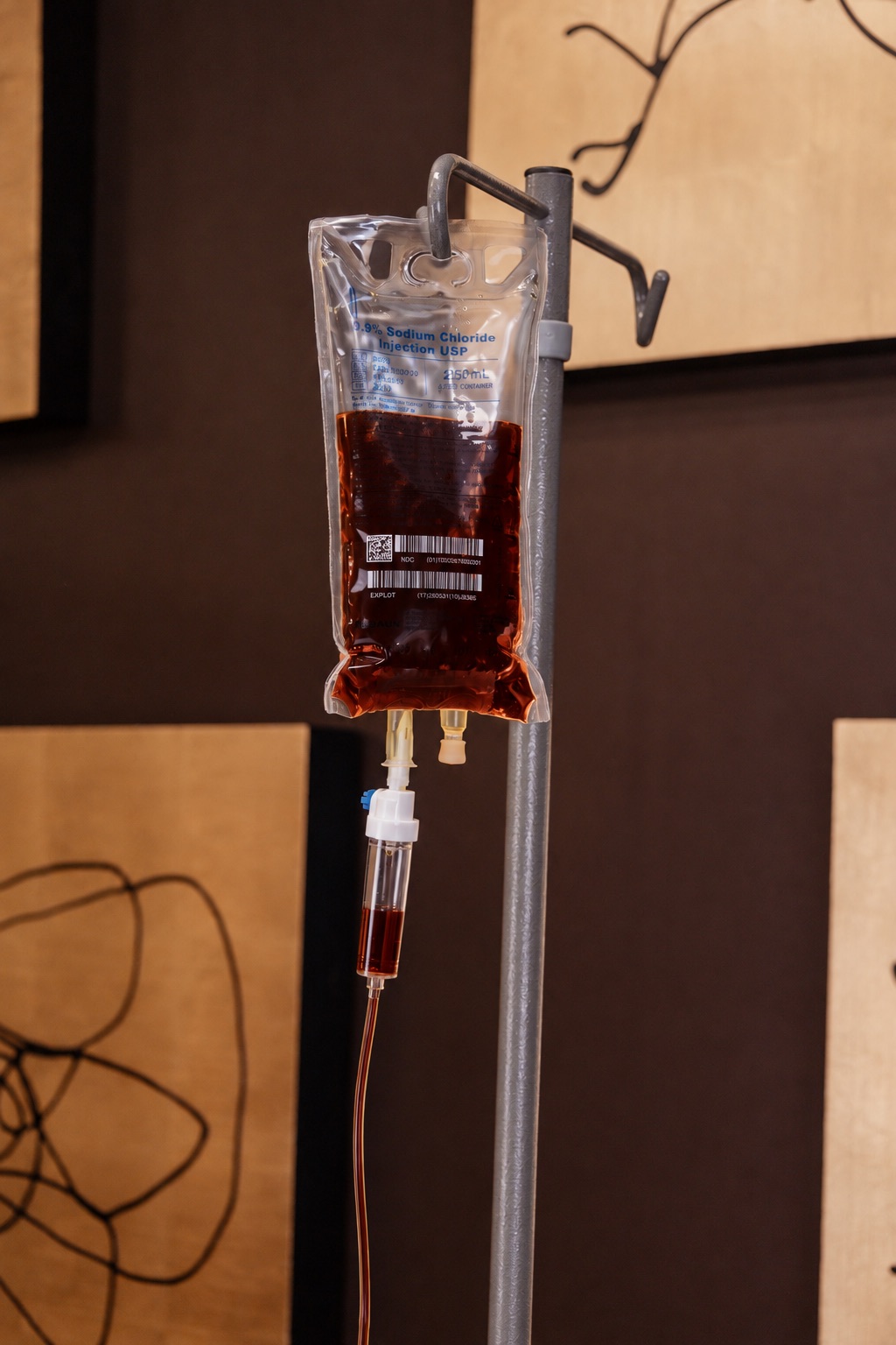 An iron infusion bag on an IV pole